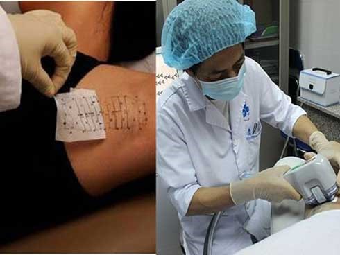 Bác sĩ tiết lộ sự thật những phương pháp điều trị hôi nách hiện nay