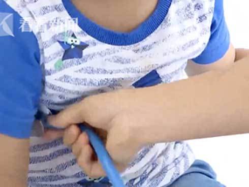 Không ăn chất béo, cô gái 23 tuổi vẫn bị gan nhiễm mỡ bởi lý do không ai ngờ tới-4
