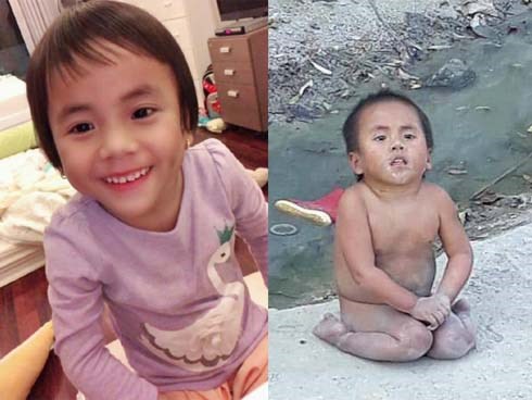 Bé Pàng liệt 2 chân không manh áo giữa trời đông từng khiến MXH dậy sóng giờ ra sao?