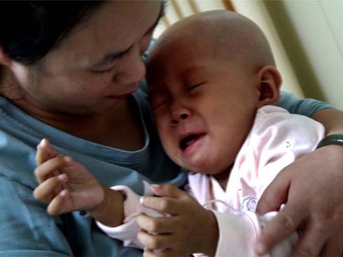 Mới 1 tuổi đã mắc bệnh ung thư máu, mẹ không ngờ rước bệnh cho con vì mua thứ này về dùng