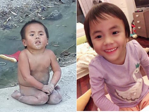 Sau 9 tháng ở với mẹ nuôi, em bé Mường Lát tật nguyền ngày nào đã được đi học chữ, ngày càng lanh lợi đáng yêu