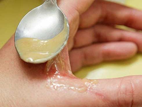 Sắn dây kết hợp cùng mật ong tạo thành chất cực độc?-2