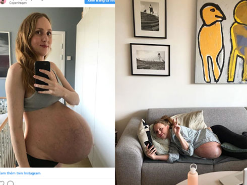 Dù đã được báo trước nhưng bà mẹ vẫn không thể tin vào mắt mình khi bác sĩ đón một đàn con trong bụng cô chào đời-10