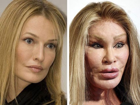 Nữ tỷ phú nghiện thẩm mỹ để chiều chồng và cái kết đắng