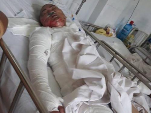 Nhan sắc và cuộc sống hiện tại của cô gái bị chồng tẩm xăng thiêu sống gây chấn động một thời ở Hưng Yên-6