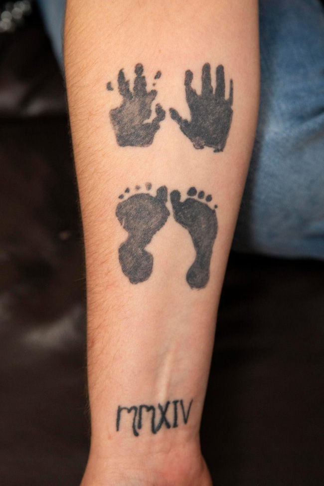 Bé sinh non bị đứt lìa người vì sai lầm của bác sĩ trong lúc đỡ đẻ-6