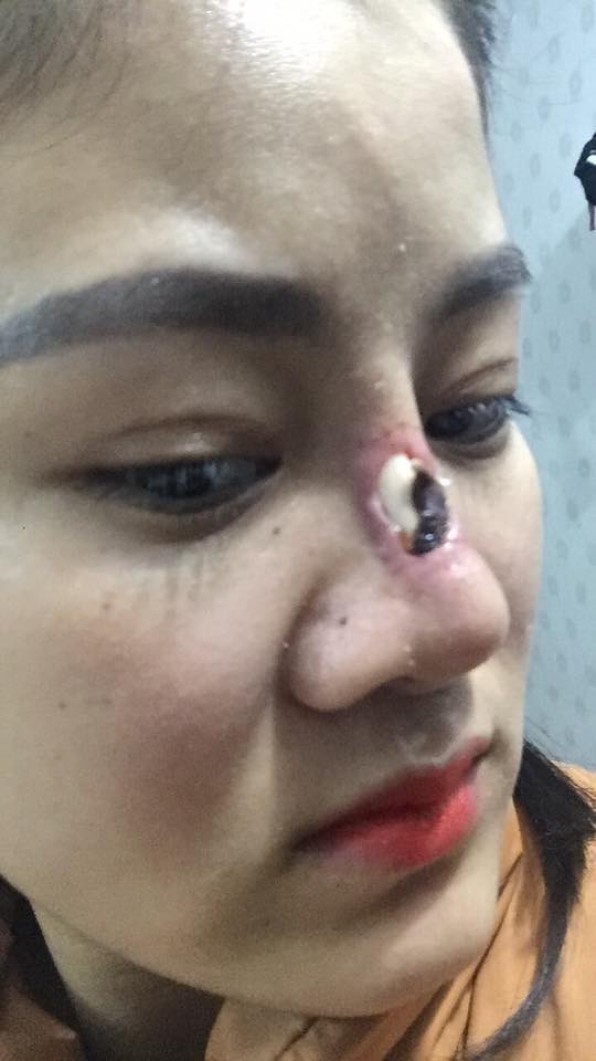 10 ca thẩm mỹ lợn lành thành lợn què vừa rùng mình vừa hài hước-4