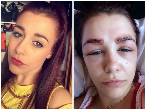 10 ca thẩm mỹ lợn lành thành lợn què vừa rùng mình vừa hài hước-8