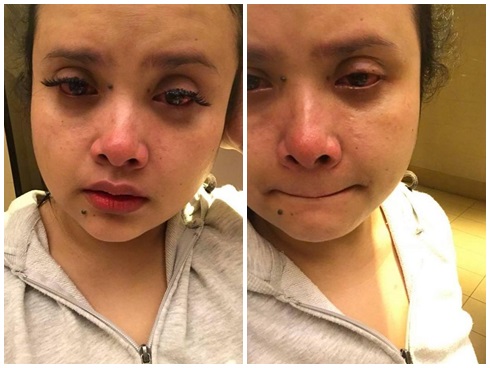 10 ca thẩm mỹ lợn lành thành lợn què vừa rùng mình vừa hài hước-9