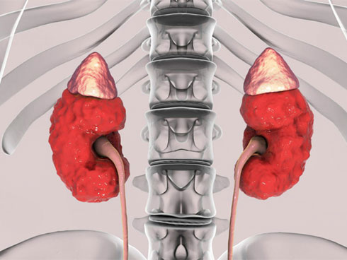 Thận có khỏe thì mệnh mới an: 8 việc bạn cần làm ngay để giữ cho thận không bị suy kiệt-1