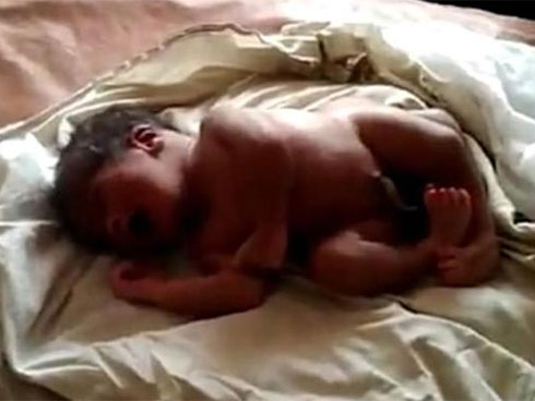 Anh ruột nhẫn tâm hành hạ và bỏ đói em gái đến thân tàn ma dại, chỉ cho ăn một lát bánh mì mỗi 4 ngày trong suốt 2 năm-5