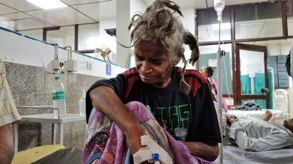 Anh ruột nhẫn tâm hành hạ và bỏ đói em gái đến thân tàn ma dại, chỉ cho ăn một lát bánh mì mỗi 4 ngày trong suốt 2 năm-1