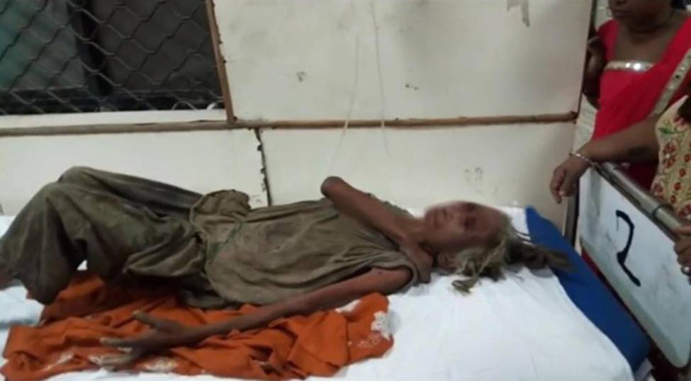 Anh ruột nhẫn tâm hành hạ và bỏ đói em gái đến thân tàn ma dại, chỉ cho ăn một lát bánh mì mỗi 4 ngày trong suốt 2 năm-2