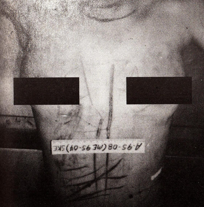 Cuồng ghen đến hóa hận, nữ sát thủ mặt thiên thần ra tay tàn độc giết hại bạn học còn lấy một phần thi thể về làm chiến lợi phẩm-5