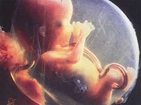 Siêu âm phát hiện nhau thai có chấm đen bí ẩn, bác sĩ cảnh báo mẹ bầu nên cẩn thận với điều này-1