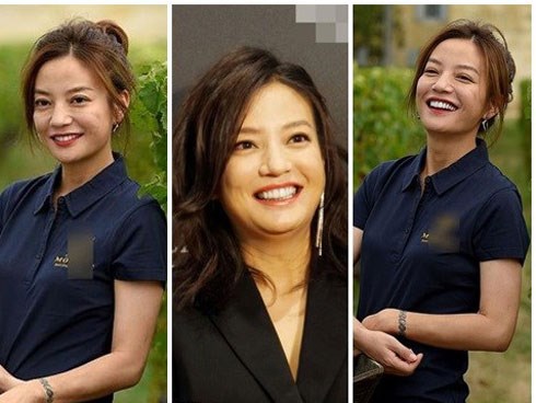 'Én nhỏ' Triệu Vy lộ da nhăn nheo, răng cái trắng cái ngà