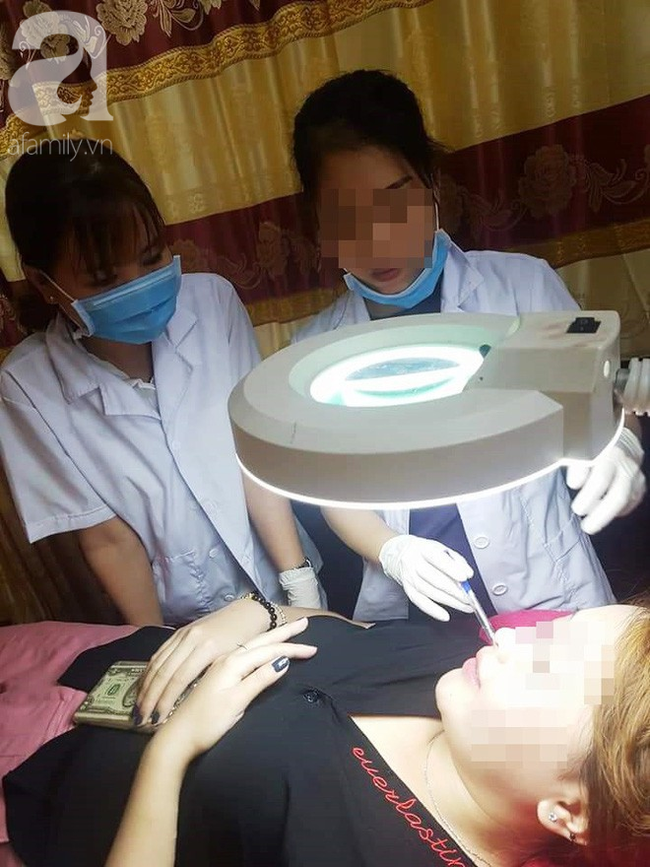 Tiêm filler nâng mũi, nữ sinh viên 20 tuổi ở Sài Gòn đối diện nguy cơ hoại tử da, mù mắt vĩnh viễn-3