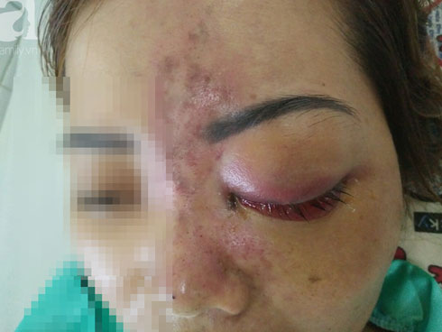 Sửa mũi cắt môi đã là gì, chị em bây giờ còn rủ nhau đi cắt da đầu để...-7