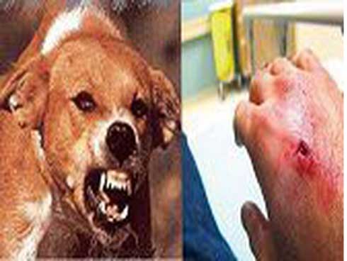 Bé trai 2 tuổi bị chó béc giê cắn lòi mắt, rạn sọ-2