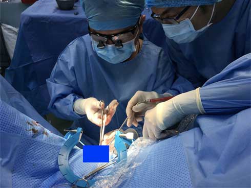 Bỏ quên cuộn dây cước câu cá vào của quý suốt 11 năm-2