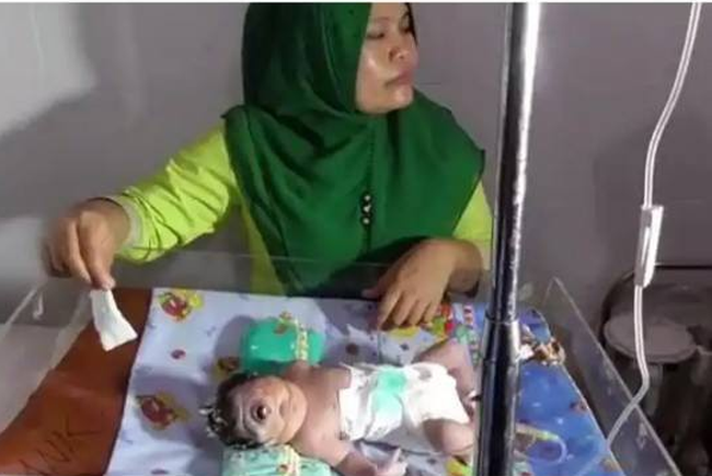 Em bé sinh ra có 1 mắt, chỉ sống được 7 giờ, nghe bác sĩ giải thích nguyên nhân mẹ mới giật mình-1