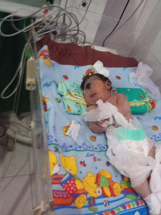 Em bé sinh ra có 1 mắt, chỉ sống được 7 giờ, nghe bác sĩ giải thích nguyên nhân mẹ mới giật mình-2