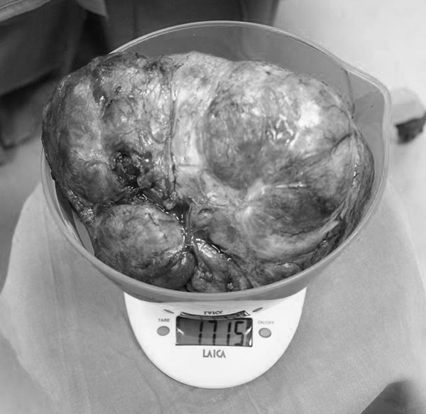 Người phụ nữ khốn khổ ngủ nghiêng vì ngực bên bé, bên to gấp 5 lần-2