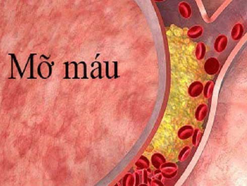 Mỗi ngày 1 bao thuốc và nửa lít rượu, mới 25 tuổi BS đã