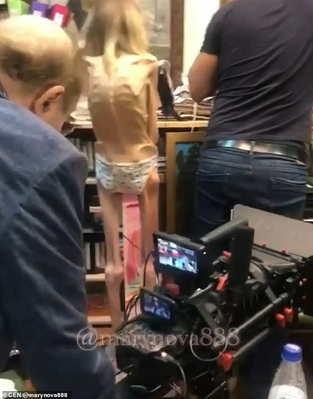 Thực hiện chế độ ăn kiêng nghiêm ngặt trong nhiều năm, cô gái 26 tuổi chỉ nặng vỏn vẹn có 17kg, cơ thể chỉ còn lại da bọc xương-4