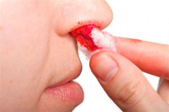 Ung thư máu: Những dấu hiệu nhận biết sớm và cảnh báo nhóm người có nguy cơ mắc bệnh cao-2