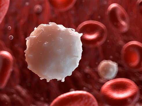 Ung thư máu: Những dấu hiệu nhận biết sớm và cảnh báo nhóm người có nguy cơ mắc bệnh cao-1