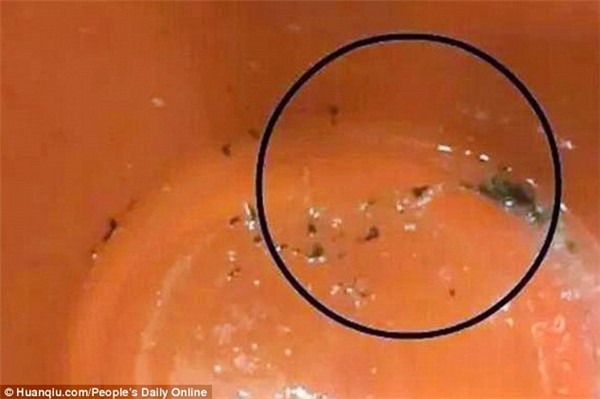 Thấy con nôn ra những mảnh vụn màu đen kỳ lạ khi đi học về, bố mẹ hốt hoảng tìm ra sự thật đau lòng-2