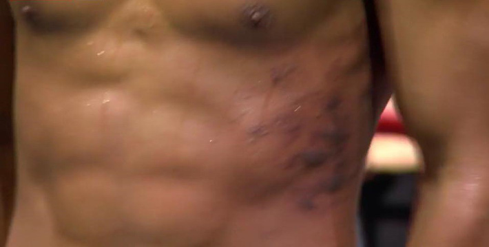 Độc cô cầu bại” Việt Nam trút liên hoàn đòn khiến võ sĩ Trung Quốc tím đen mạng sườn-4