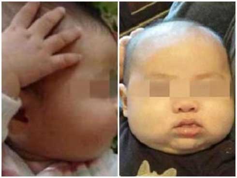 Thấy con hay sờ đầu, gãi tai, mẹ ngỡ ngàng khi biết con mắc bệnh lúc nào không hay-1