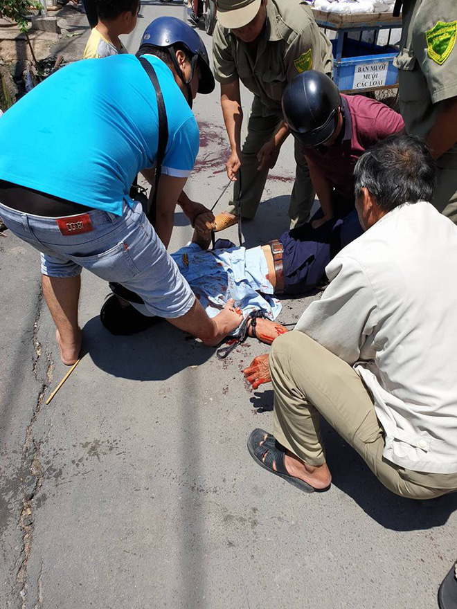 Bảo vệ nghi ngáo đá cầm dao tự cắt tay giữa chợ ở Sài Gòn-2