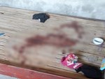 Hoàn cảnh đáng thương của bé gái tử vong với vết cứa trên cổ nghi bị bố sát hại-4