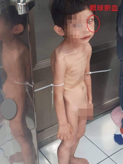 Đến nhà chồng cũ thăm con, người phụ nữ suýt ngất trước cảnh tượng khủng khiếp của con trai 3 tuổi ngay tại ban công trước cửa nhà-2