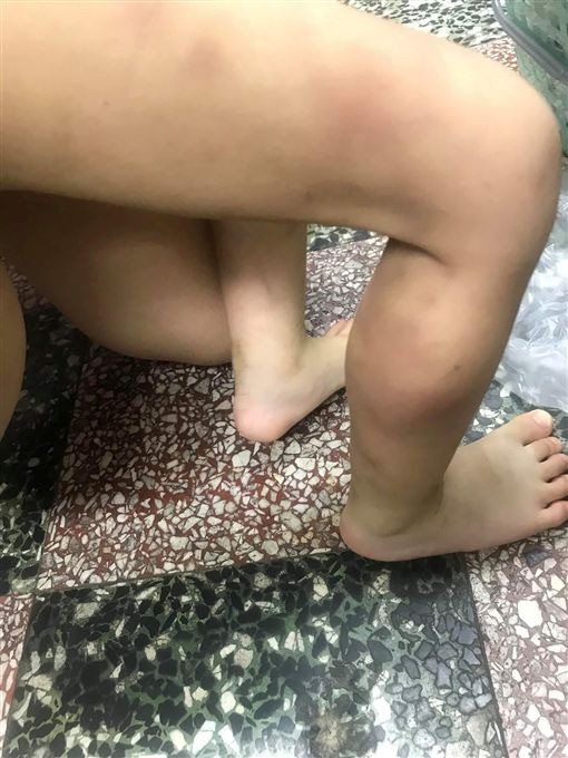 Đến nhà chồng cũ thăm con, người phụ nữ suýt ngất trước cảnh tượng khủng khiếp của con trai 3 tuổi ngay tại ban công trước cửa nhà-7