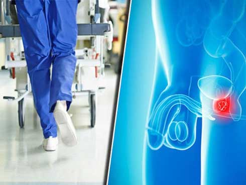 3 dạng ung thư nguy hiểm ở nam giới-1