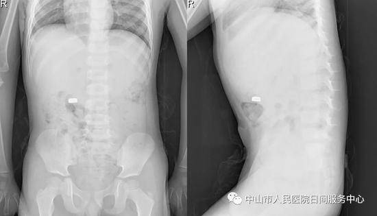 Sau khi nghe bí mật của cậu con trai 4 tuổi, người mẹ hốt hoảng đưa con đến bệnh viện-1