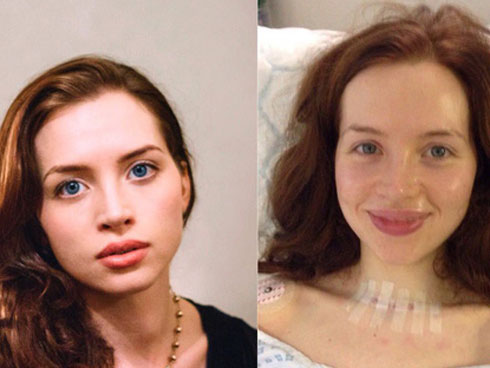 Thiếu vitamin này, cơ thể dễ bị ung thư hơn: Nguồn cung sẵn trong tự nhiên, hãy tận dụng-4