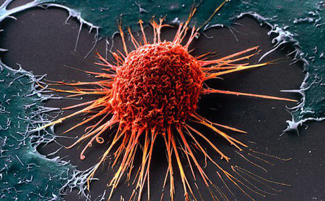 Thiếu vitamin này, cơ thể dễ bị ung thư hơn: Nguồn cung sẵn trong tự nhiên, hãy tận dụng-1