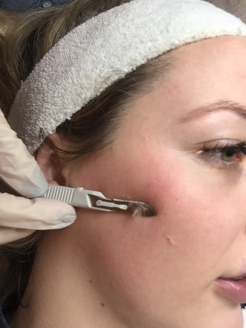 Mục sở thị cạo mặt - phương pháp làm đẹp ghê rợn nhưng sướng mắt, da mịn như da em bé-2