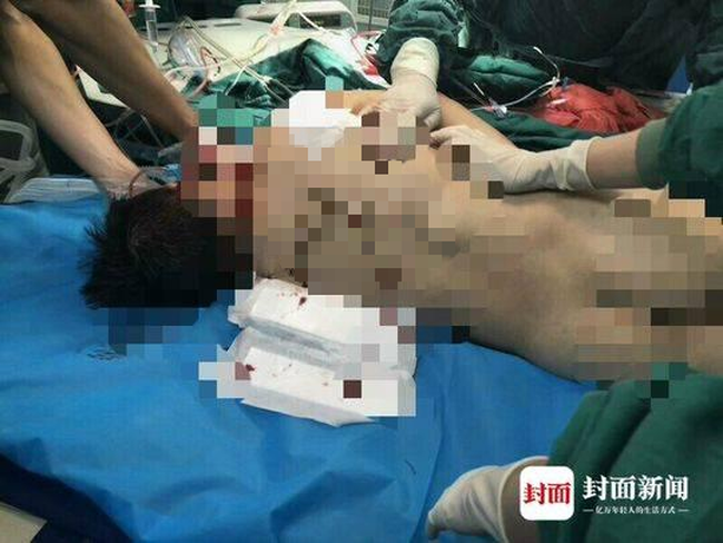 Tức giận vì con gái đi học bị bạn đánh, người bố đến trường thay mặt con trả thù khiến dư luận phẫn nộ-3