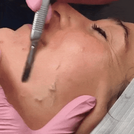 Mục sở thị cạo mặt - phương pháp làm đẹp ghê rợn nhưng sướng mắt, da mịn như da em bé-1