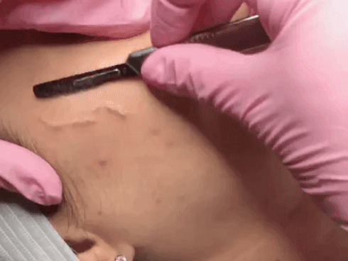 Mục sở thị cạo mặt - phương pháp làm đẹp ghê rợn nhưng sướng mắt, da mịn như da em bé