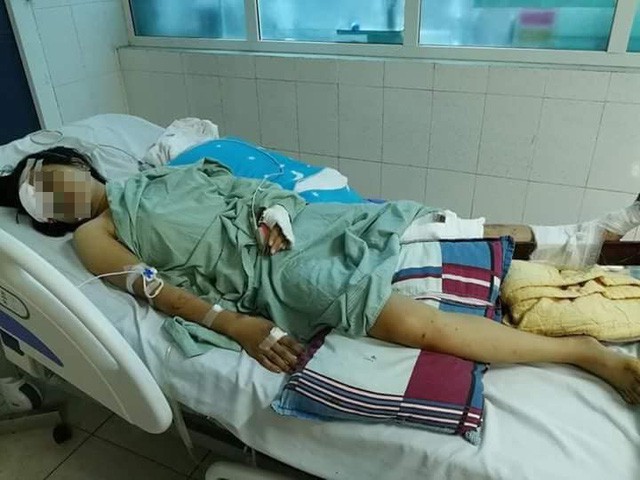 Vụ tai nạn giao thông khiến 13 người tử vong tại Lai Châu: Thoát cửa tử nhưng đối mặt với tận cùng nỗi đau-1