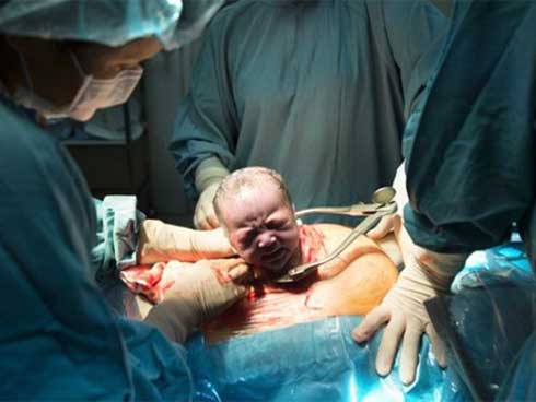 Sau mũi tiêm gây tê tủy sống, mẹ và thai nhi 39 tuần tử vong-2