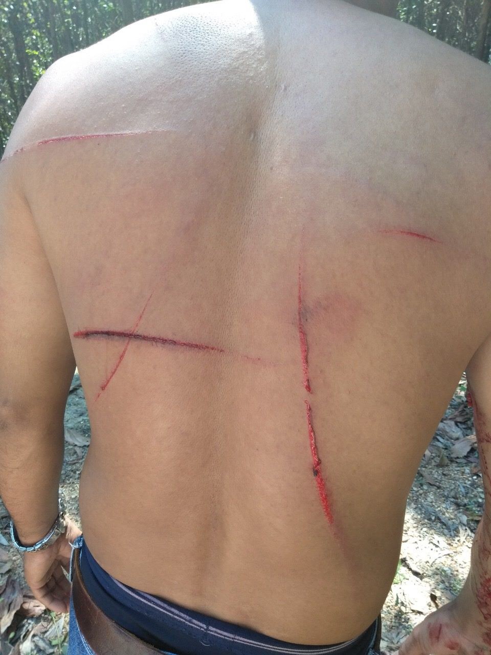 Tranh giành phần đất chôn người chết, 2 gia đình đuổi chém nhau kinh hoàng-2