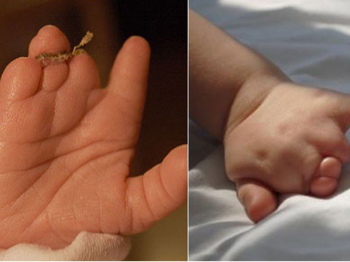 Khoảnh khắc lạ lùng: Em bé chui đầu ra khỏi bụng mẹ nhưng bọc ối vẫn còn nguyên-3